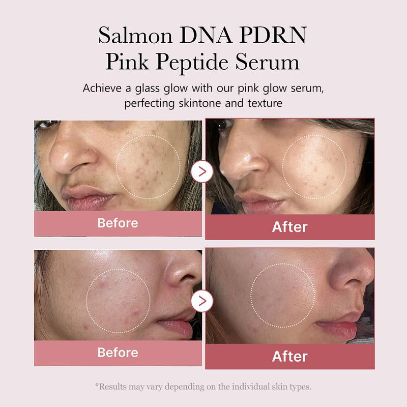 310M K-Beauty PDRN Spot Care SET ㅣ K-Beauty Viral Glass Glow Device + Salmon PDRN Pink Peptide Serum